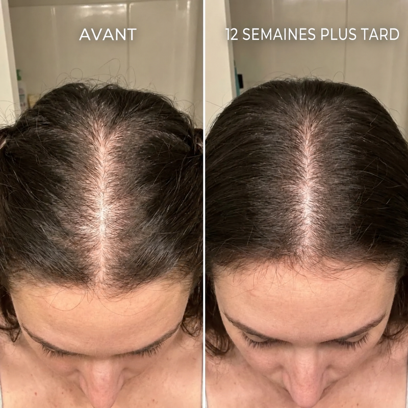 Résultat